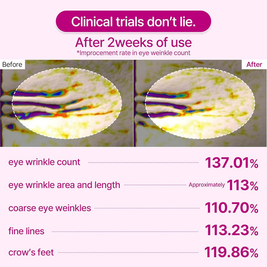 Revitalize Your Eyes: Cemenrete Calcium Volume Eye Patch for Wrinkles, Puffiness & Dark Circles (60 Patches)
