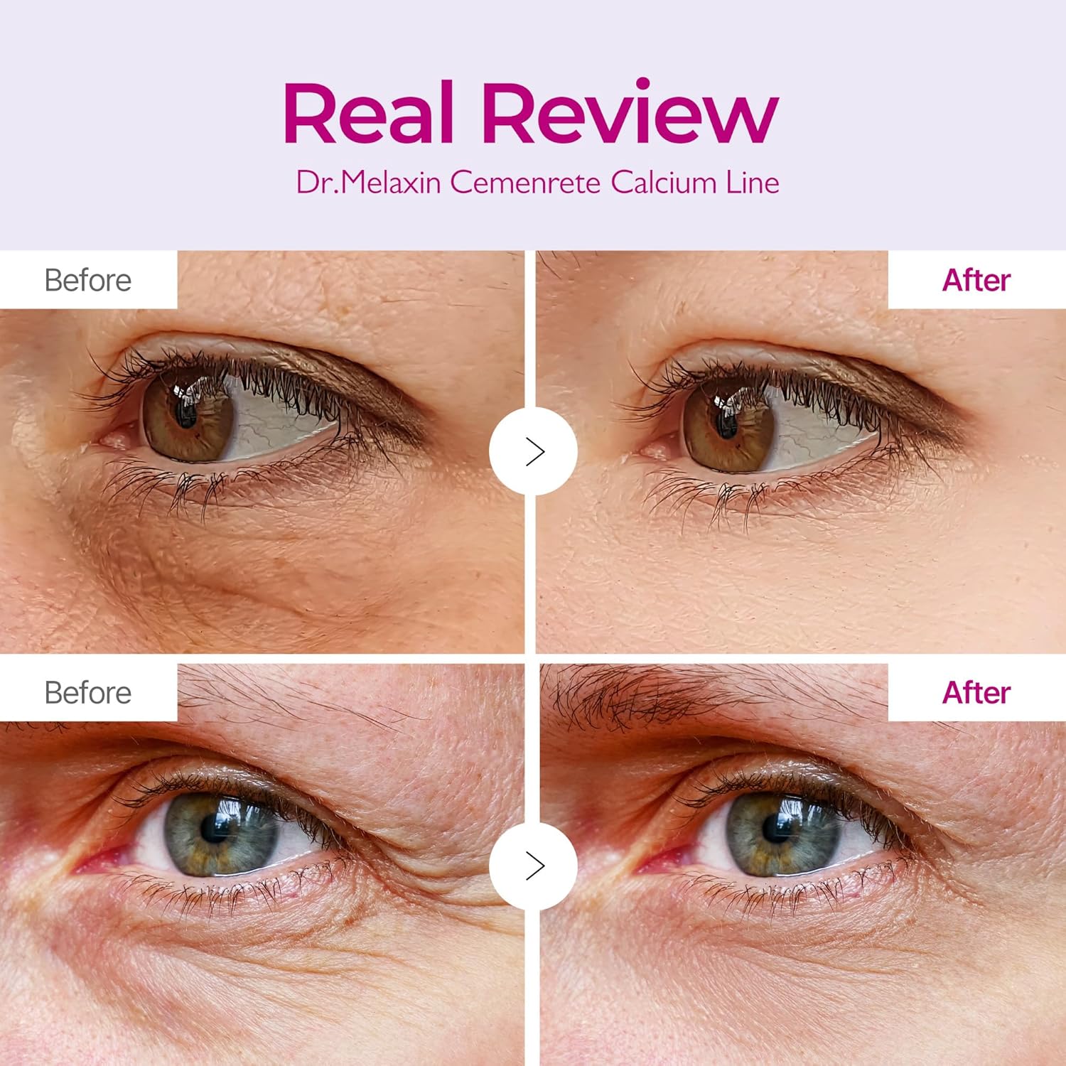 Revitalize Your Eyes: Cemenrete Calcium Volume Eye Patch for Wrinkles, Puffiness & Dark Circles (60 Patches)